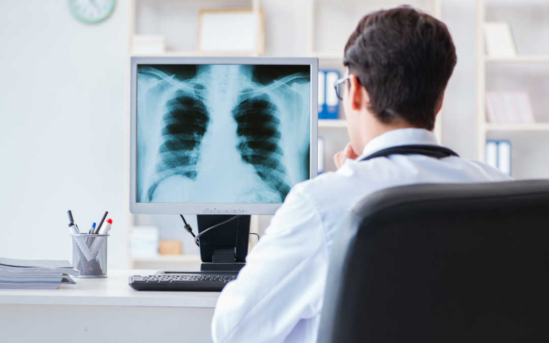 Are You Over X-rayed?