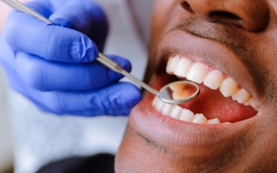 Don’t Get Bitten by 2026 Dental Codes