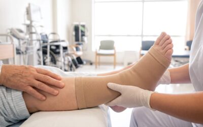 The Big Squeeze: Closing the Gap on Lymphedema Treatment Billing
